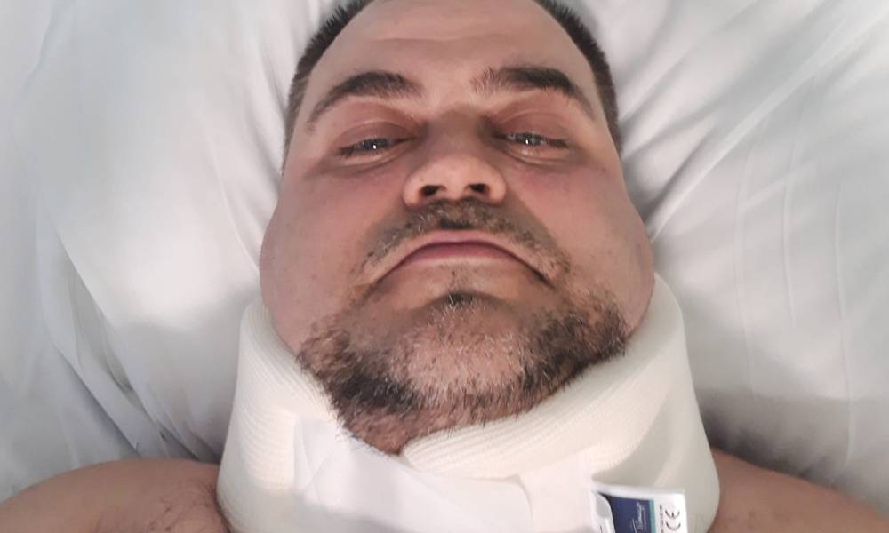 Krzysztof Czub ma złamanych 11 żeber. Przebywa w szpitalu. Fot. arch. prywatne